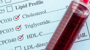 Cholesterol | Fakty a mýty v súvislosti s cholesterolom